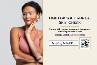 Classic · Split: Time For Your Annual Skin Check