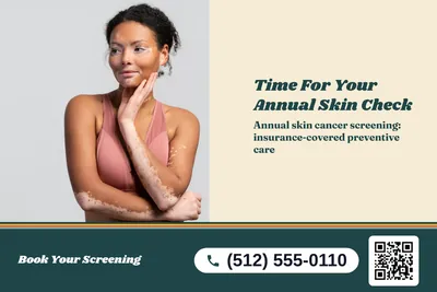 Retro 70s · Split: Time For Your Annual Skin Check