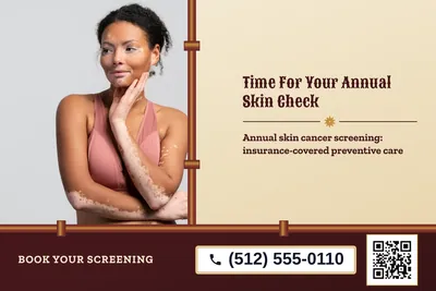 Steampunk · Split: Time For Your Annual Skin Check