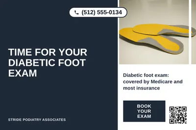 Bold Color Block · Vertical Split: Time For Your Diabetic Foot Exam